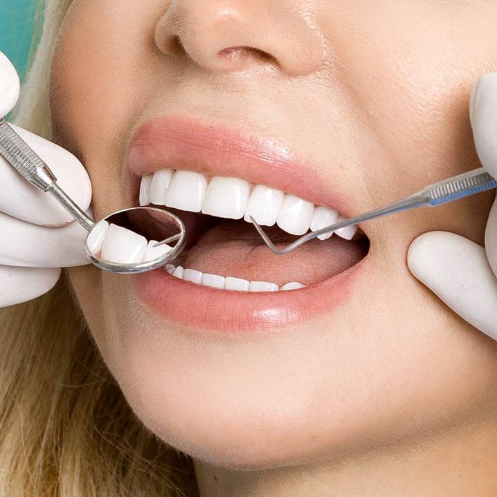 Зубной дозор — стоматологическая клиника в Твери